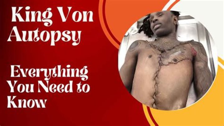 Dayvon Bennett Autopsy Report Analysis