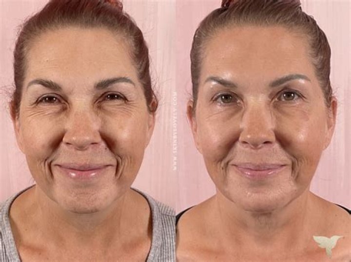 The Ageless Beauty And Her Journey To Youthful Radiance